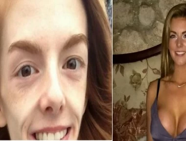 Πώς την έσωσε η… σοκολάτα - Ζύγιζε 30 κιλά (φωτο)